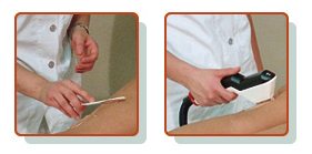 dauerhafte und permanente haarentfernung mit haarpoint
